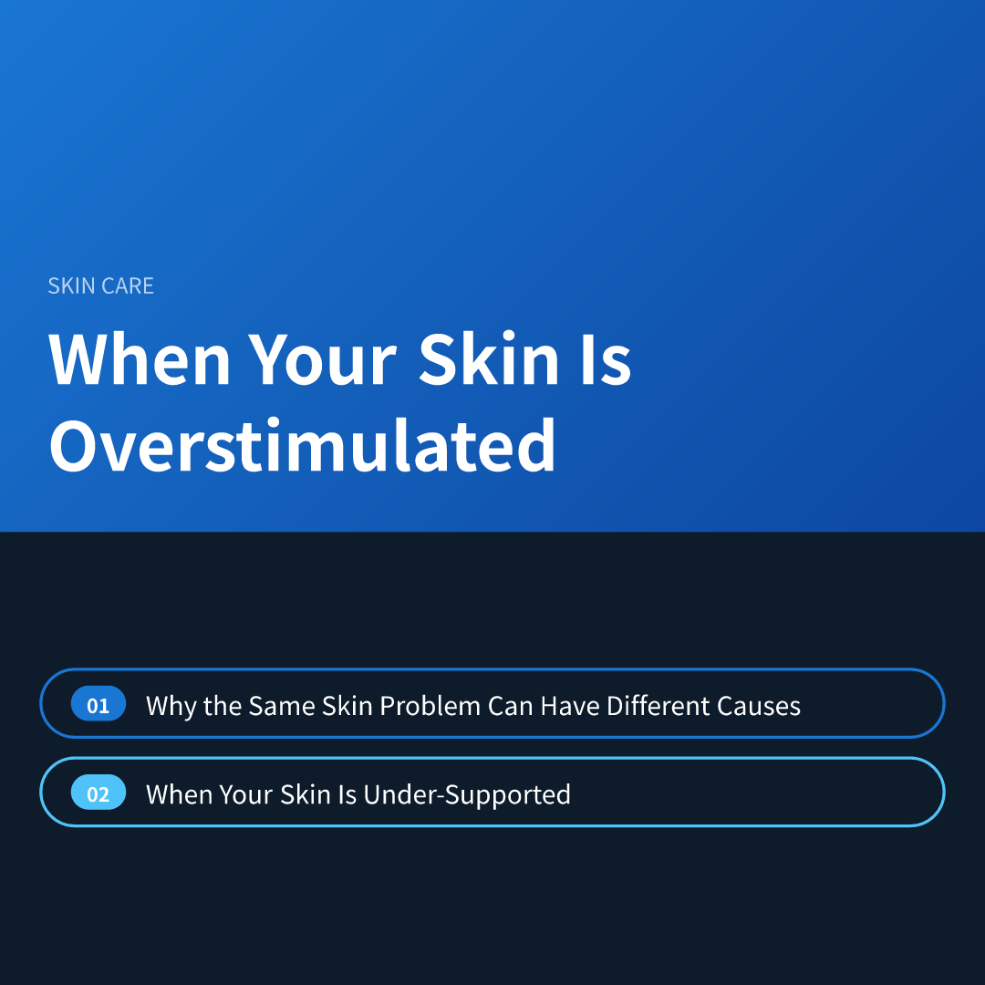 When Your Skin Is Overstimulated