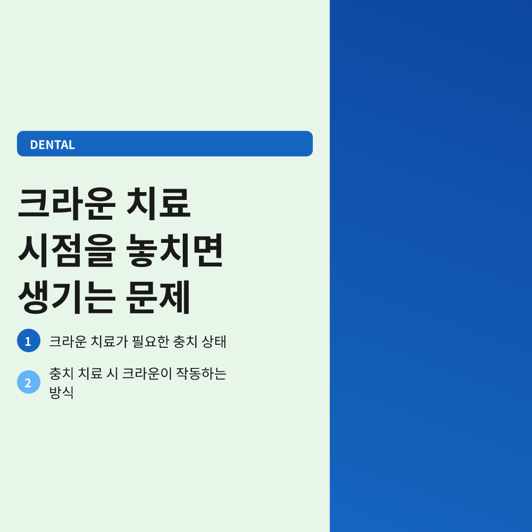 충치 크라운 언제 해야하나 이미지 4
