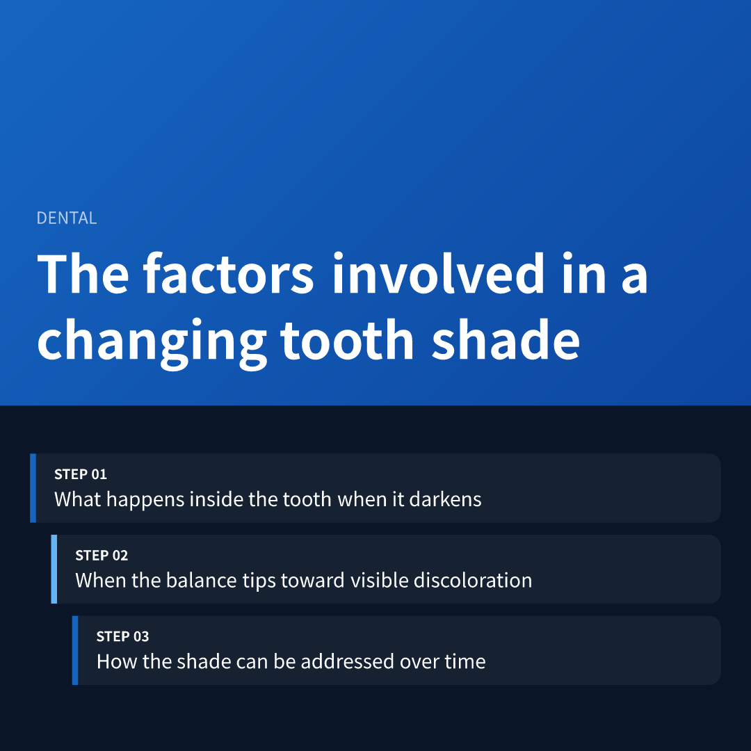 The factors involved in a changing tooth shade