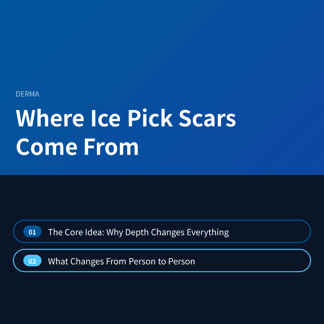Where Ice Pick Scars Come From