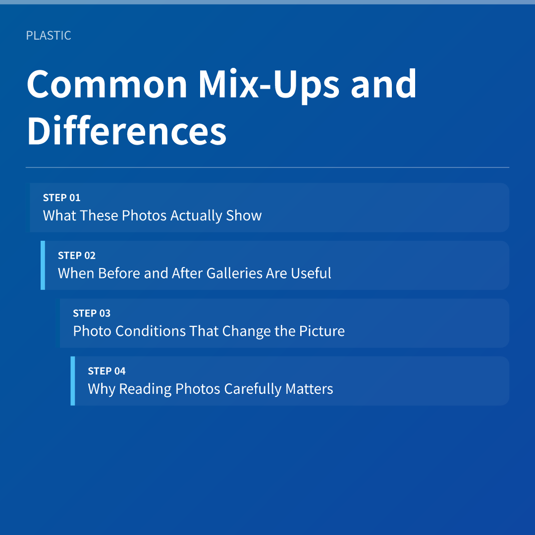 Common Mix-Ups and Differences