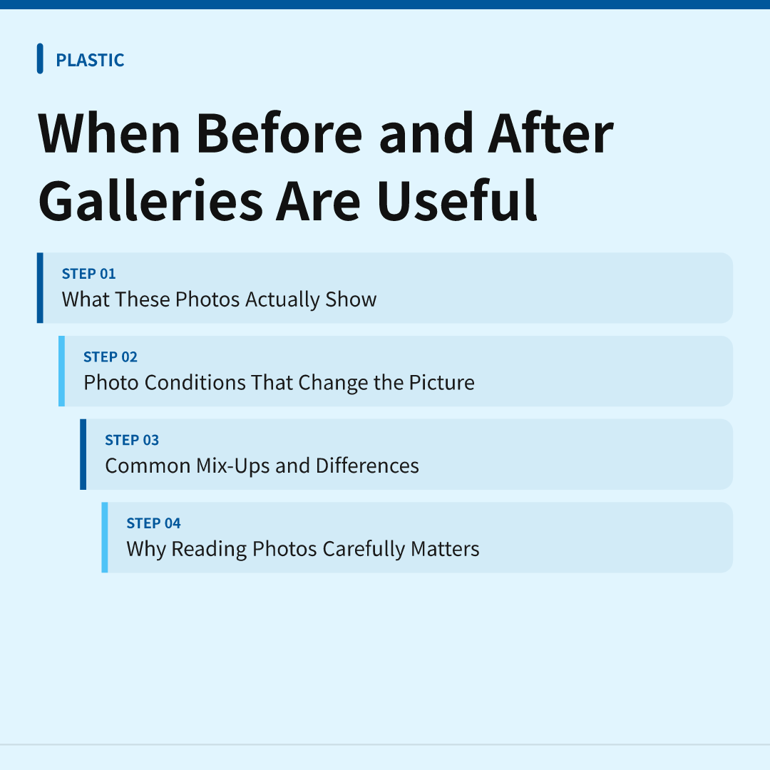 When Before and After Galleries Are Useful