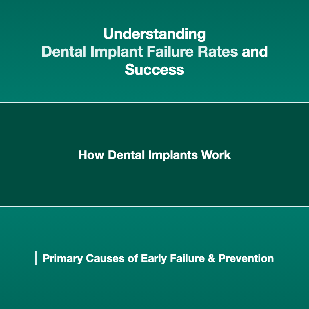 Understanding Dental Implant Success and Failure Rates - dental implant failure rates and causes