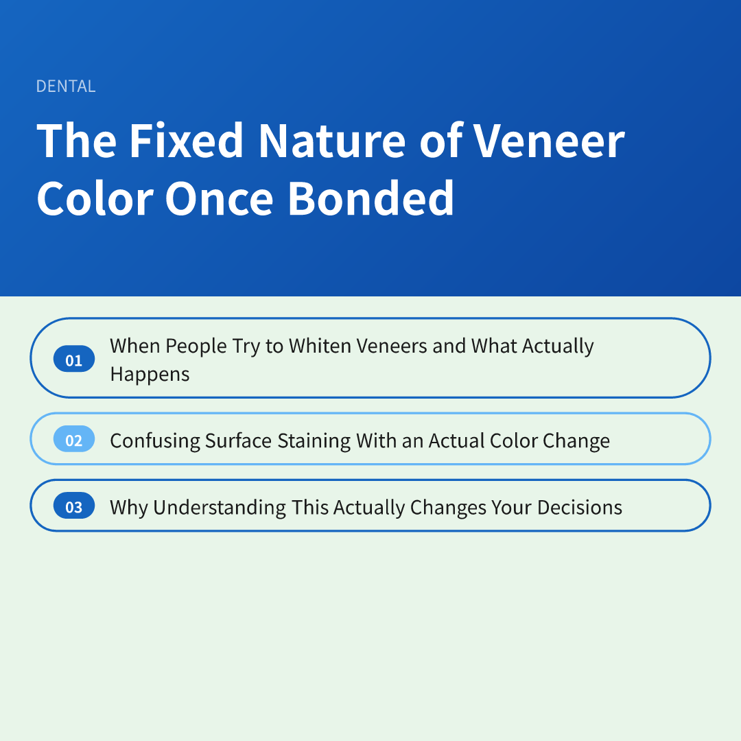 The Fixed Nature of Veneer Color Once Bonded - can veneers be whitened after placement