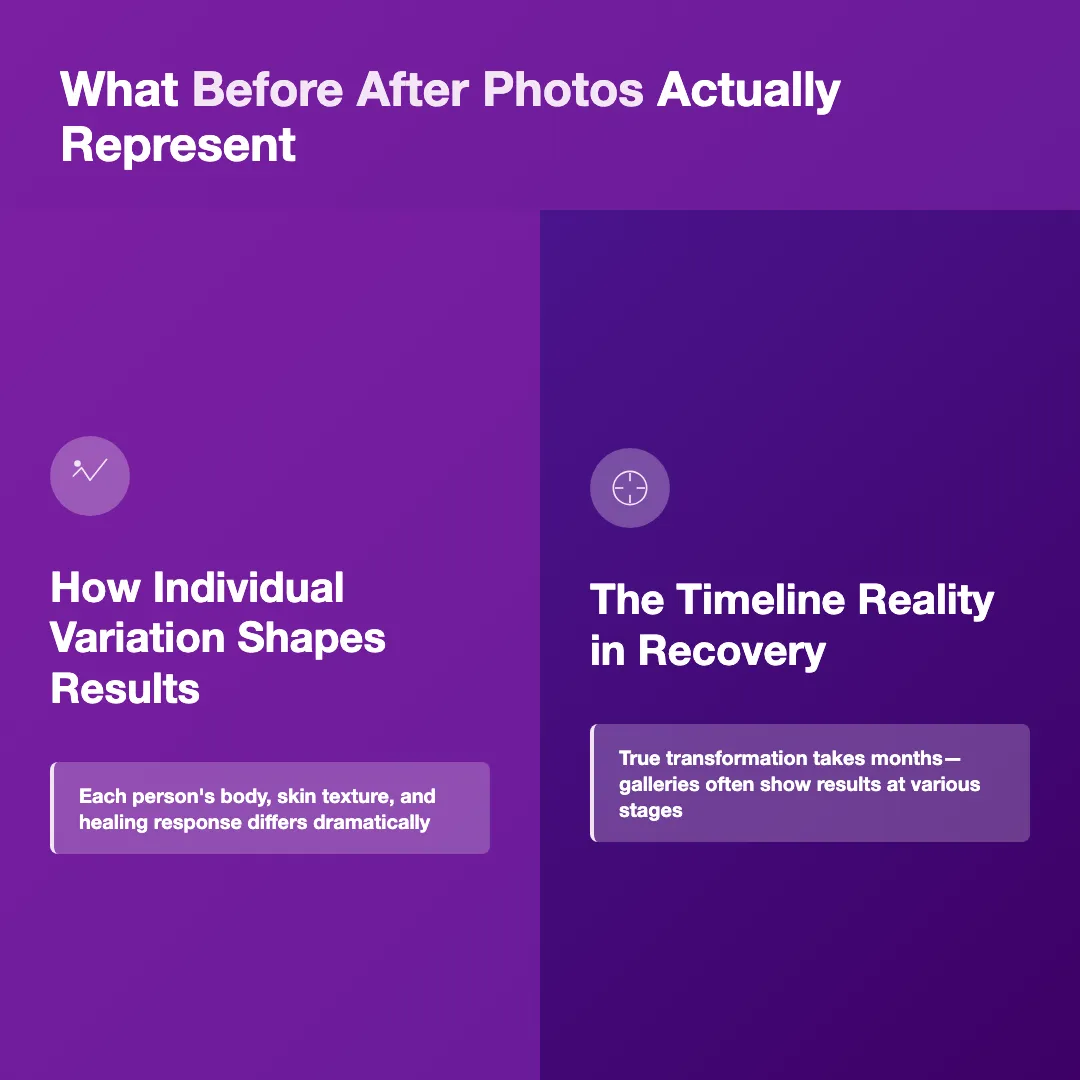 What Before After Photos Actually Represent - plastic surgery before after gallery